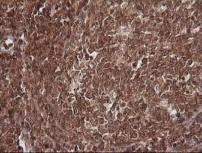 Immunohistochemistry: MAGEA4 Antibody (OTI2C1) [NBP2-45720]