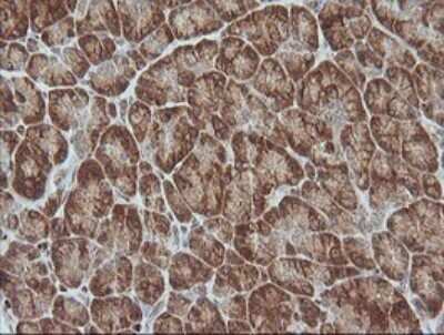 Immunohistochemistry: MAGEA4 Antibody (OTI2C1) [NBP2-45720]
