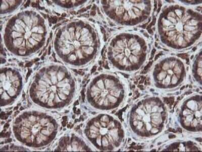 Immunohistochemistry: MAGEA4 Antibody (OTI2C1) [NBP2-45720]