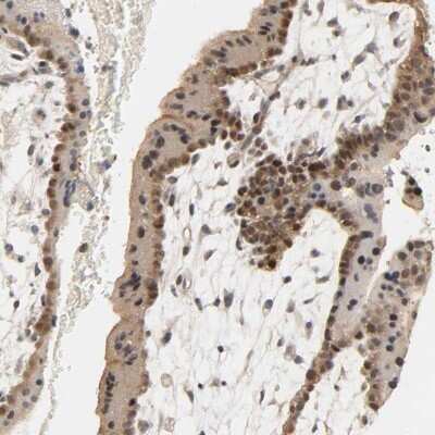 Immunohistochemistry-Paraffin: MAGEA8 Antibody [NBP1-92097]