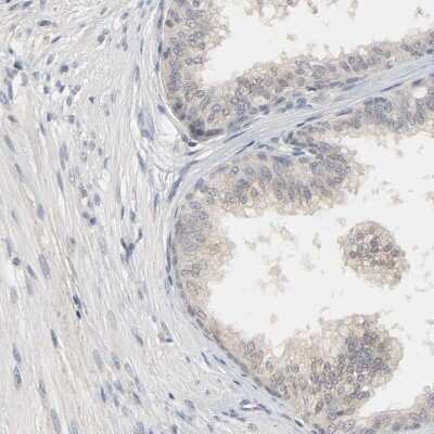 Immunohistochemistry-Paraffin: MAGEA8 Antibody [NBP1-92097]