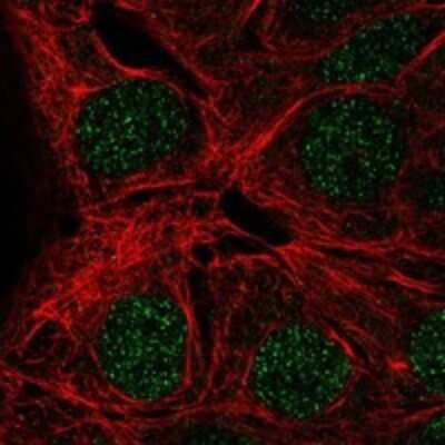 Immunocytochemistry/ Immunofluorescence: MAGEA9 Antibody [NBP3-17884]
