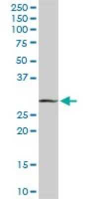Western Blot: MAGEA9 Antibody [H00004108-D01P]