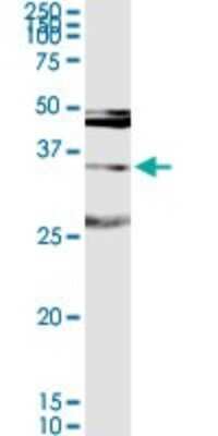 Western Blot: MAGEA9 Antibody [H00004108-D01P]
