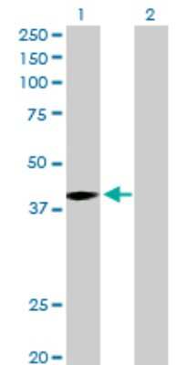 Western Blot: MAGEA9 Antibody [H00004108-D01P]