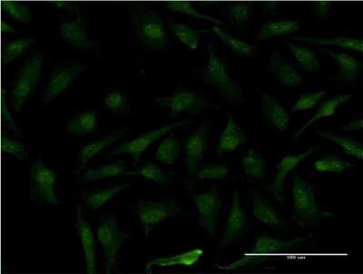 Immunocytochemistry/ Immunofluorescence: MAGEB1 Antibody (3C1) [H00004112-M09]