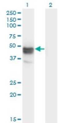 Western Blot: MAGEB1 Antibody (3C1) [H00004112-M09]