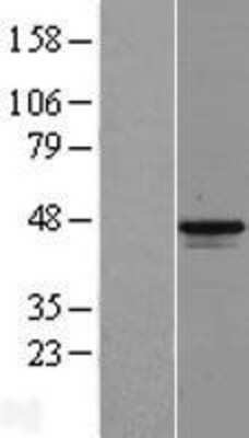 Western Blot: MAGEB1 Overexpression Lysate [NBL1-12807]