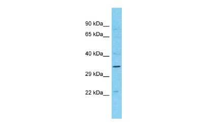 Western Blot: MAGEB10 Antibody [NBP2-83171]