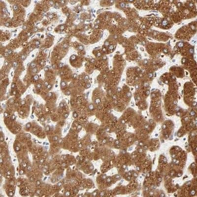 Immunohistochemistry-Paraffin: MAGEB17 Antibody [NBP1-87594]