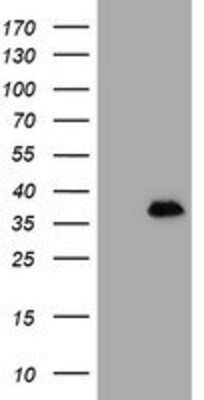 Western Blot: MAGEB18 Antibody (OTI1F5) [NBP2-03679]