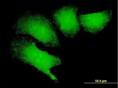 Immunocytochemistry/ Immunofluorescence: MAGEB18 Antibody [H00286514-B01P]