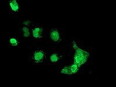 Immunocytochemistry/ Immunofluorescence: MAGEB18 Antibody (OTI1F5) - Azide and BSA Free [NBP2-72575]
