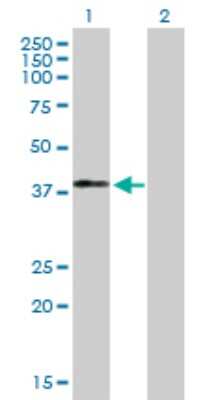 Western Blot: MAGEB18 Antibody [H00286514-B01P]
