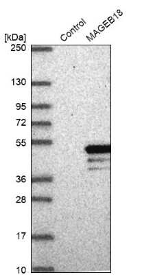 Western Blot: MAGEB18 Antibody [NBP2-14211]