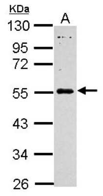Western Blot: MAGEB18 Antibody [NBP2-17206]