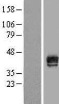 Western Blot: MAGEB18 Overexpression Lysate [NBL1-12808]