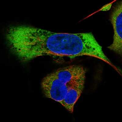 Immunocytochemistry/ Immunofluorescence: MAGEB2 Antibody [NBP2-57072]