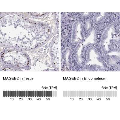 Immunohistochemistry-Paraffin: MAGEB2 Antibody [NBP2-62688]
