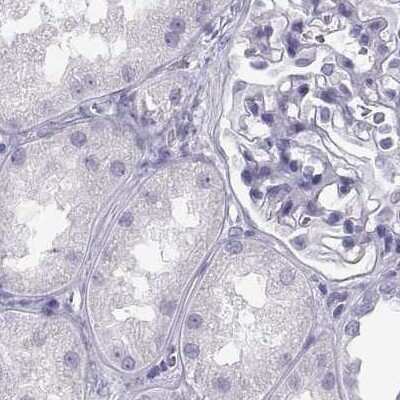 Immunohistochemistry-Paraffin: MAGEB2 Antibody [NBP2-62688]