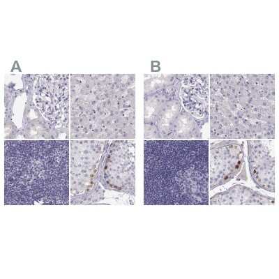 Immunohistochemistry-Paraffin: MAGEB2 Antibody [NBP2-62697]