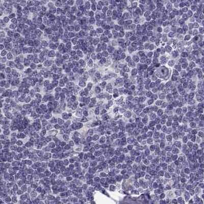 Immunohistochemistry-Paraffin: MAGEB2 Antibody [NBP2-62697]