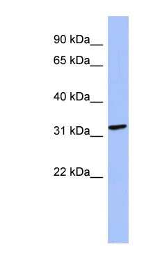 Western Blot: MAGEB2 Antibody [NBP1-56838]