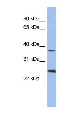 Western Blot: MAGEB2 Antibody [NBP1-56839]