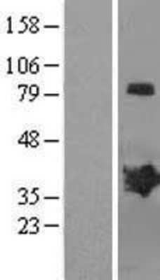 Western Blot: MAGEB2 Overexpression Lysate [NBL1-12809]