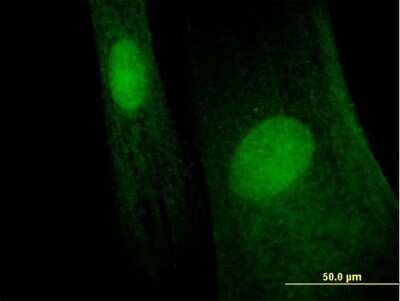 Immunocytochemistry/ Immunofluorescence: MAGEB6 Antibody [H00158809-B01P]