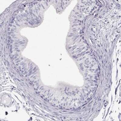 Immunohistochemistry-Paraffin: MAGEC1 Antibody [NBP1-85397]