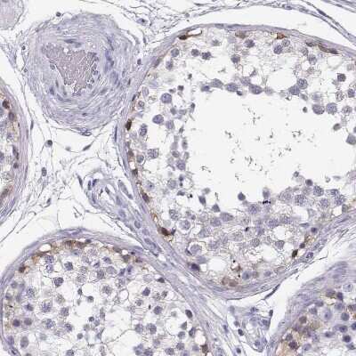 Immunohistochemistry-Paraffin: MAGEC1 Antibody [NBP1-85397]