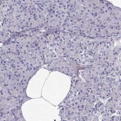 Immunohistochemistry-Paraffin: MAGEC1 Antibody [NBP1-85397]