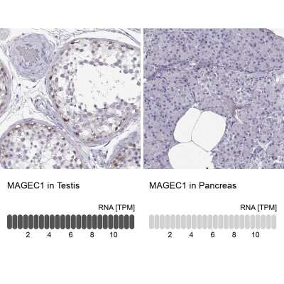 Immunohistochemistry-Paraffin: MAGEC1 Antibody [NBP1-85397]