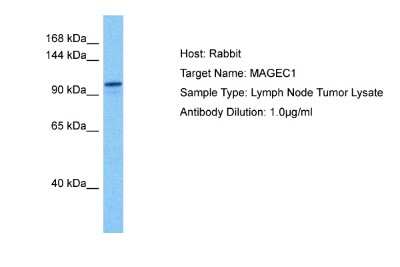 Western Blot: MAGEC1 Antibody [NBP2-83173]