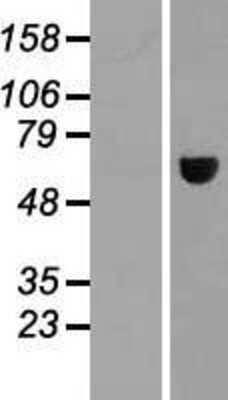 Western Blot: MAGEE2 Overexpression Lysate [NBL1-12819]