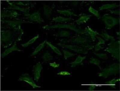 Immunocytochemistry/ Immunofluorescence: MAGI1 Antibody (3B4) [H00009223-M02]