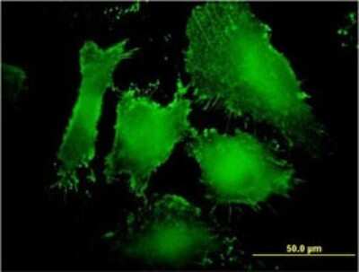 Immunocytochemistry/ Immunofluorescence: MAGI1 Antibody (7B4) [H00009223-M03]