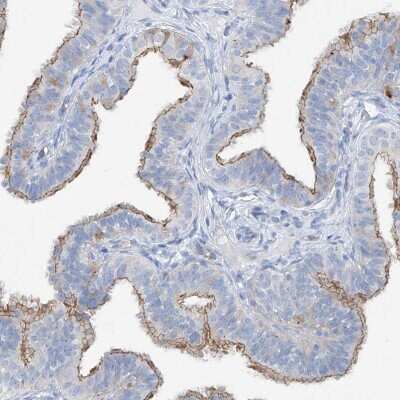 Immunohistochemistry-Paraffin: MAGI1 Antibody [NBP1-89182]