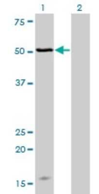 Western Blot: MAGOH Antibody (4H8) [H00004116-M02]