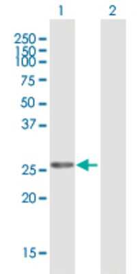 Western Blot: MAGP-1/MFAP2 Antibody [H00004237-B01P]