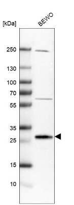 Western Blot: MAGP-2/MFAP5 Antibody [NBP1-82803]