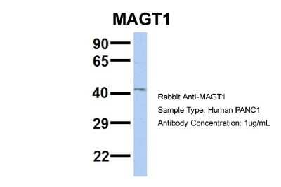 Western Blot: MAGT1 Antibody [NBP1-69683]
