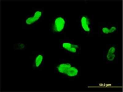 Immunocytochemistry/ Immunofluorescence: MAK Antibody (3E5) [H00004117-M01]