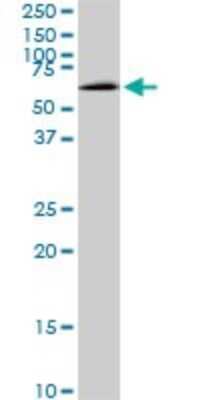 Western Blot: MAK Antibody (3E5) [H00004117-M01]