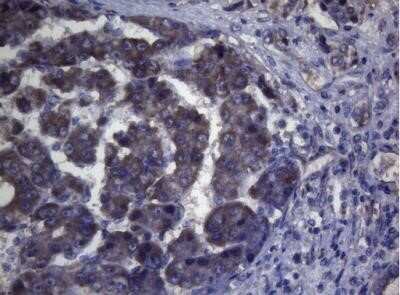 Immunohistochemistry: MAK Antibody (OTI5A7) - Azide and BSA Free [NBP2-72580]