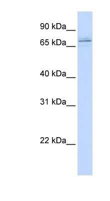 Western Blot: MAK Antibody [NBP1-54991]