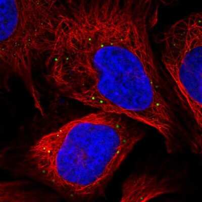 Immunocytochemistry/ Immunofluorescence: MAK10 Antibody [NBP2-58424]