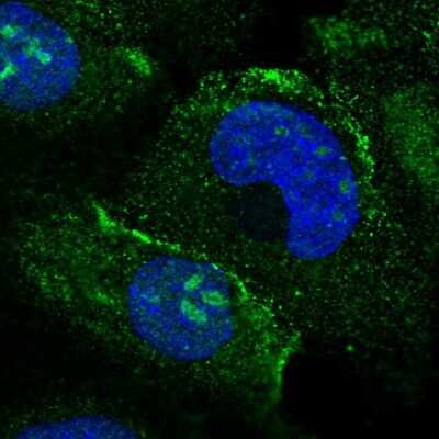 Immunocytochemistry/ Immunofluorescence: MAK16 Antibody [NBP2-47309]