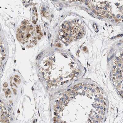 Immunohistochemistry-Paraffin: MALSU1 Antibody [NBP1-86026]